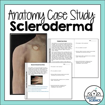Preview of Student Case Study for Integumentary System - Disorder of the Skin