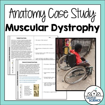 Preview of Student Case Study for Muscular System - Duchenne Muscular Dystrophy