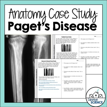 Preview of Student Case Study for Skeletal System - Bone Remodeling Disorder