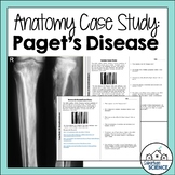 Student Case Study for Skeletal System - Bone Remodeling Disorder