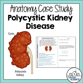 Preview of Student Case Study for Urinary System - Cystic Kidney Disease