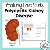 Student Case Study for Urinary System - Cystic Kidney Disease