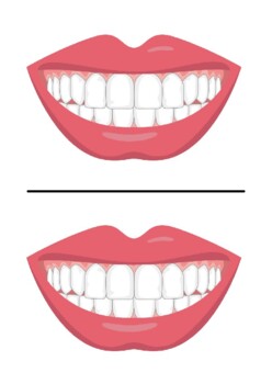 Preview of Teeth/Mouth Template (Activity - Brushing Teeth)