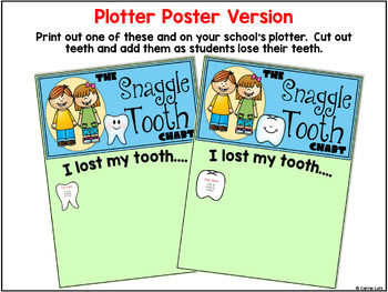 Tooth Chart For Losing Teeth