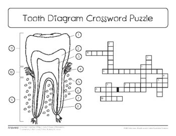 Tooth Diagram Sketch Crossword Simple Crossword Puzzles Daily Crossword