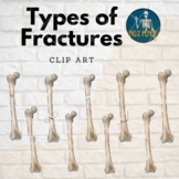 Types of Fractures Bone Anatomy Clip Art, Femur
