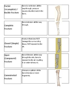 Preview of Types of Fractures Card Sort Activity