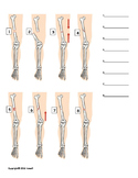 Types of Fractures Identification Quiz or Worksheet