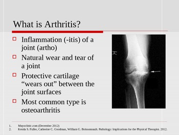 Preview of Understanding Arthritis