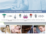 Understanding Sexually Transmitted Infections