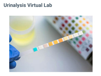 Preview of Urinalysis Virtual Lab