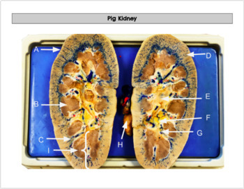 lab assignment urinary system