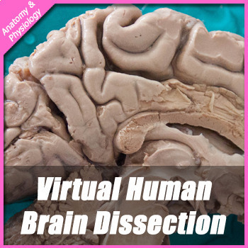 Preview of Virtual Human Brain Dissection