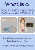 What is a Broken Bone?