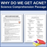 Why Do We Get Acne? - Science Comprehension Passage & Acti
