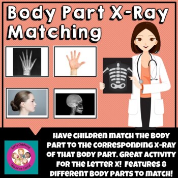 Preview of X Ray Body Part Matching Activity