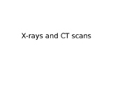 X-Rays and CT Scans