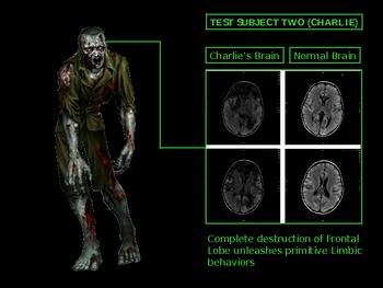 Zombie Virus PowerPoint by William Mathes | Teachers Pay Teachers