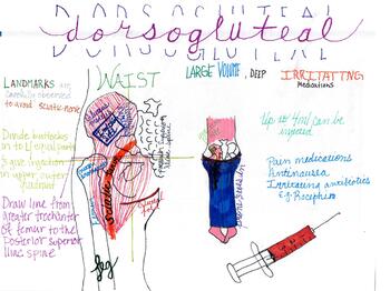 Preview of concept map- injections- dorsogluteal
